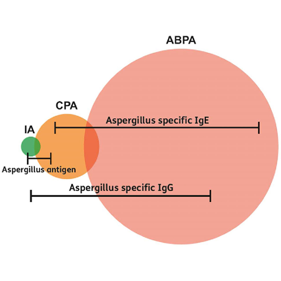 Aspergillus IgA Antibody